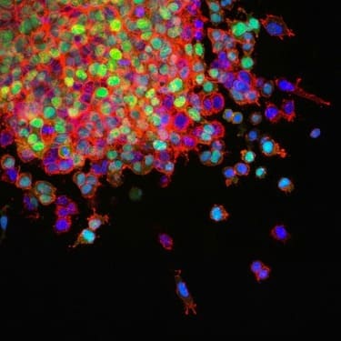 NEOPLASM- TOP - RATED DEATH-DEFYING DISEASE IN NETHERLANDS?